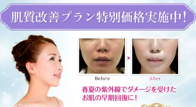 伤疤修复，重塑肌肤之美