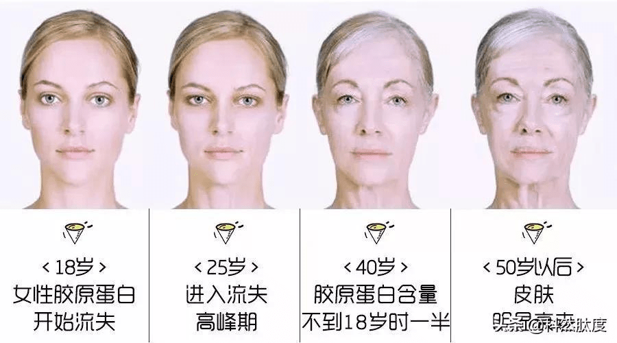 玻尿酸填充泪沟，重塑眼部年轻态的秘密武器