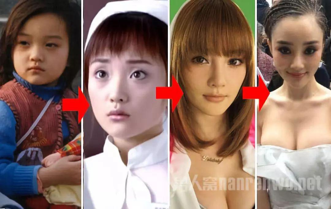 从平凡到非凡，张萌的整容之路与自我超越