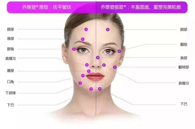 填充鼻唇沟，重拾青春轮廓的微妙艺术
