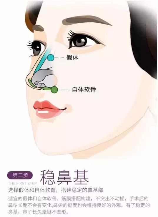 鼻子整容整形，追求完美与自然平衡的艺术