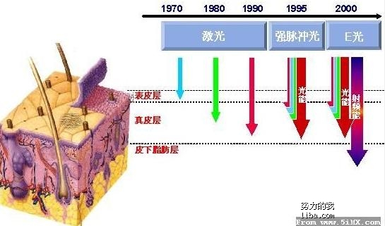 激光技术，有效解决红血丝问题的新篇章