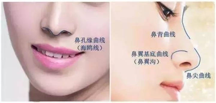 隆鼻材料，从自然到创新的完美选择