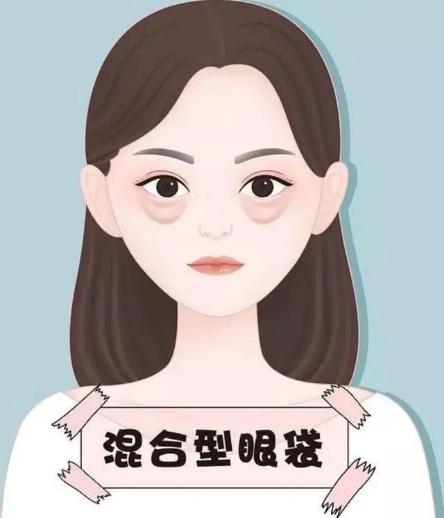 吸脂去下眼袋，重拾年轻明眸的秘密武器