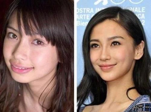 杨颖，从自然美到公众视野的蜕变——整容前后的真实故事