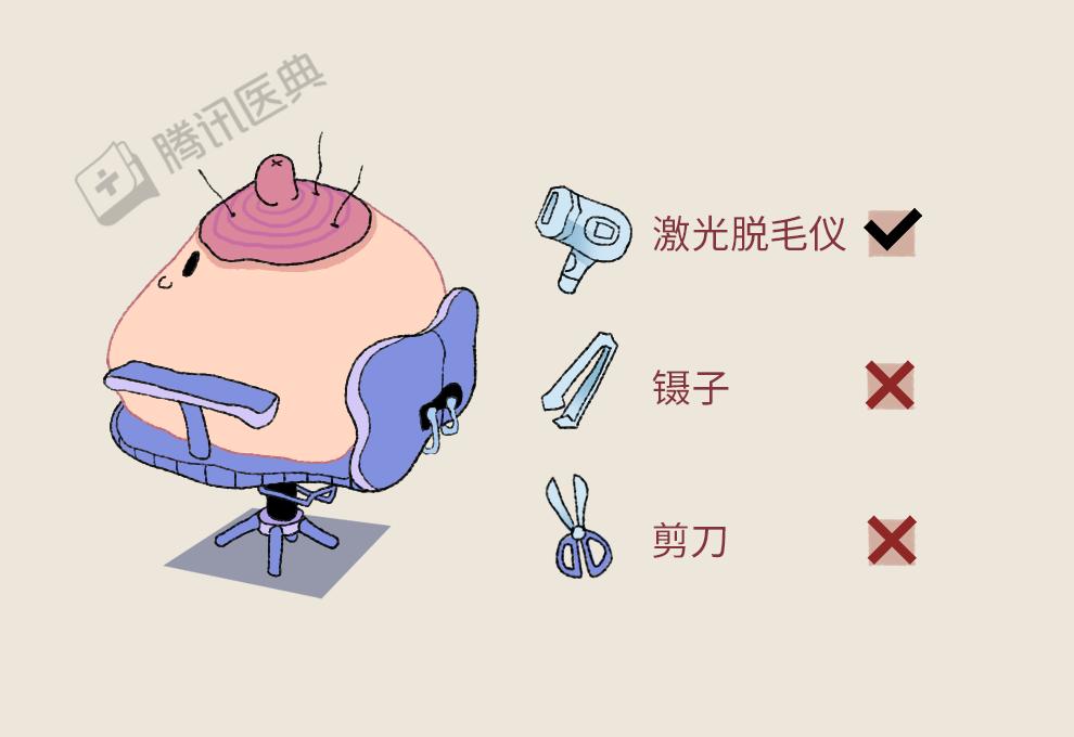 激光脱毛，安全与效果的全面解析
