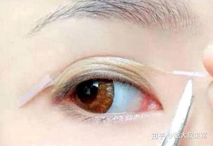 哪种双眼皮贴最好用？——全面解析与选购指南