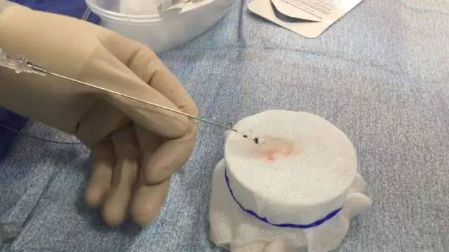 消除手术疤痕，现代医学与自然疗法的完美结合