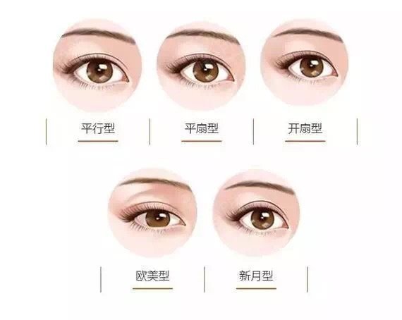 双眼皮整形手术，美丽之眼的秘密