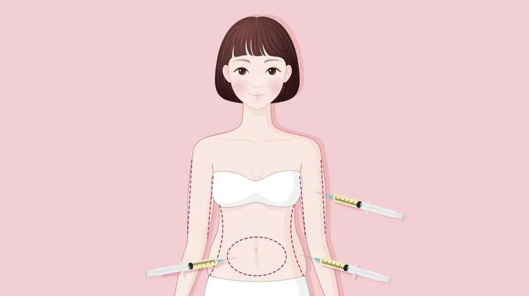 吸脂术，重塑身形的美学艺术与科学实践