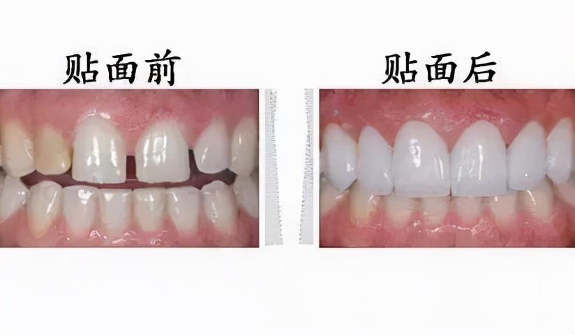 怎样美白，科学方法与日常习惯的完美结合