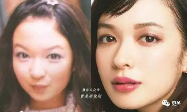 现代审美趋势下的下巴整形整容，追求完美轮廓的背后