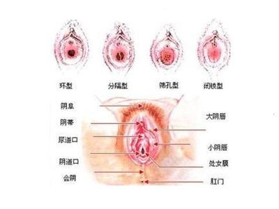 处女膜修复手术，理解、选择与关怀