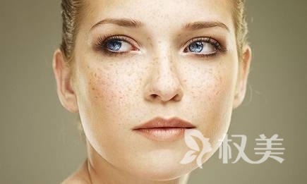 激光美容去斑，科技与美丽的完美邂逅