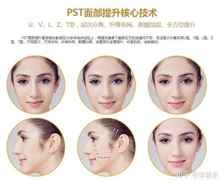 鼻翼收缩手术，重塑面部轮廓的精细艺术