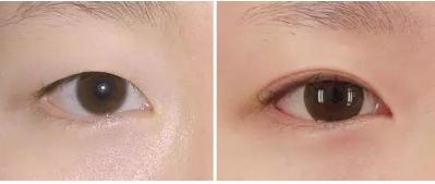 美丽之眼的秘密
