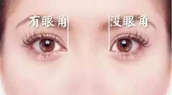 欧式双眼皮，东方美学的时尚新宠