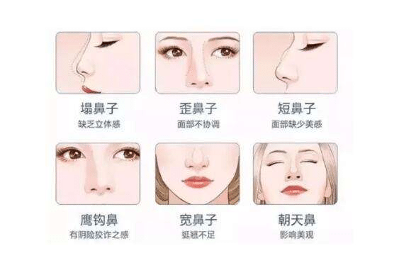 鼻子整形，价格、选择与期望
