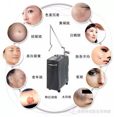 激光祛斑后，全面护理与注意事项指南