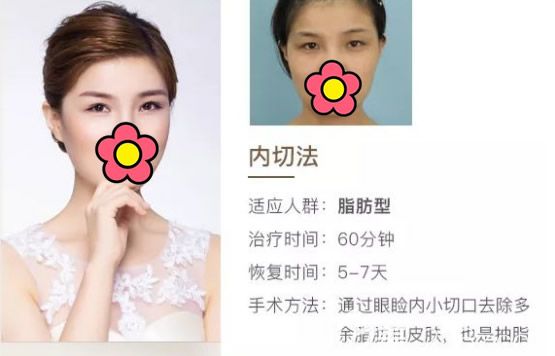 百达丽整容机构