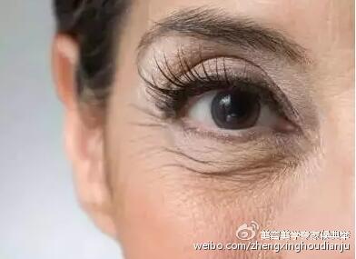 鱼尾纹的秘密，医院里的时光倒流之旅