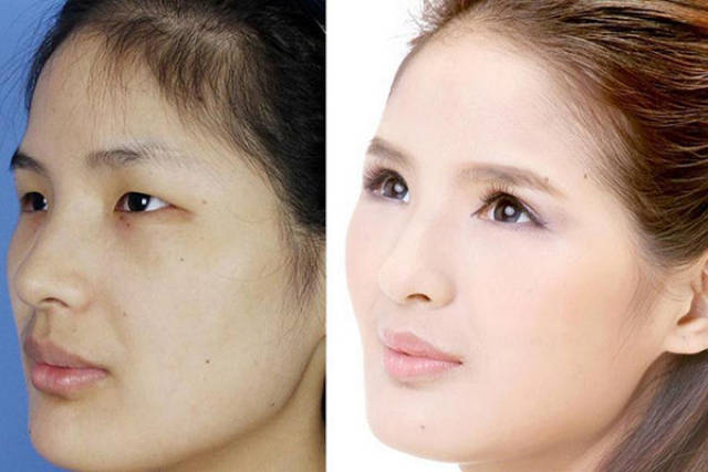 整形整容，如何选择一个好的医疗机构